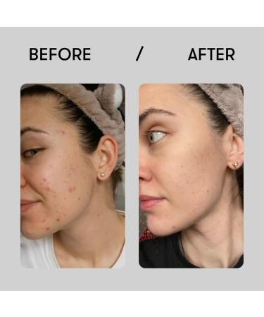 Sane Hyaluronic Acid Serum with Vitamin B5 & PP - Hydrating Face Serum for Healthy Skin - 1.01 fl oz - Buy Online on GoSupps.com