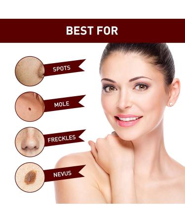 Wipe Off Tags & Moles Remover Fast Easy Effective Quick & Safe Remove Skin Tags Moles Remover Pen 1/2/3/5 PCS - Buy Online on GoSupps.com