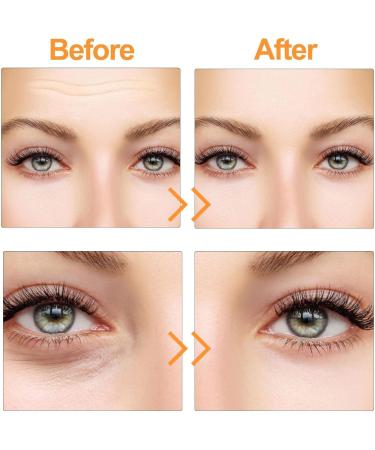 Hyaluronic Acid Facial Essence Skin Firming Rejuvenating Essence Facial Essence Hydrating Moisturizing Skin Care Refreshing Non-Sticky Firming Essence For All Skin Types - Buy Online on GoSupps.com