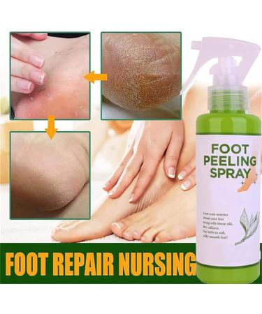 Foot Peeling Spray Orange Oil Foot Peeling Spray That Remove Dead Skin Tea Tree Foot Peeling Spray Remove Dead Skin within Seconds Exfoliator For Cracked Rough Heels Dry Toe Skin&Calluses (Green) - Buy Online on GoSupps.com