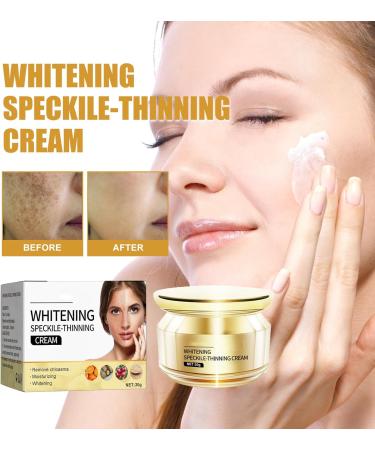 KOAHDE Whitening Freckle Cream Facial Spot Removing Cream Moisturizing Anti-Blemish Cream Spot Lightening Cream for Face Dark Spots Remover Skin Whitening Cream Brightening Whitening Tone up Cream - Buy Online on GoSupps.com