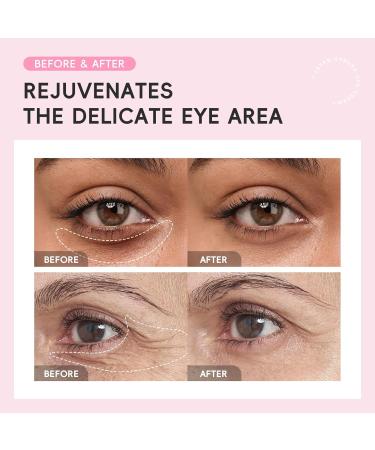 AKARY Sakura Eye Cream & Under Eye Serum for Dark Circles and Puffiness Hydrating Firming 360 Cooling Massage Roller Ball Eyes Treatment Serum Improve Skin Elasticity Wrinkles Fine Lines - Buy Online on GoSupps.com