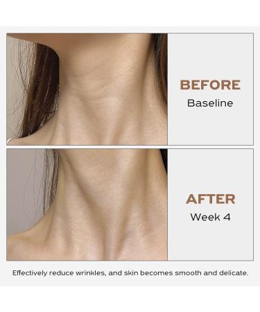 IGAME Firming Neck Cream - Boost Elasticity Reduce Wrinkles & Hydrate Skin | 1.8Oz - Youthful Neck Solution - Buy Online on GoSupps.com