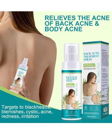 Skin care spray 120 ml liquid for impurities on the back for women men and young people body back arms legs - Buy Online on GoSupps.com