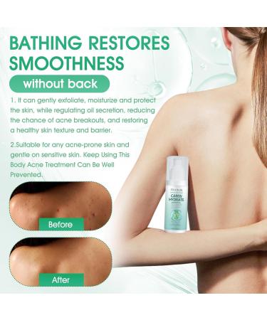 Back Acne Treatment Spray Back & Body Acne Treatment Acne Body Spray Tea Tree Oil for Skin Smooth Moisturiser for Acne Prone Skin Acne Moisturiser Gentle Repair Back Shoulder/Body /Chest /Butt - Buy Online on GoSupps.com