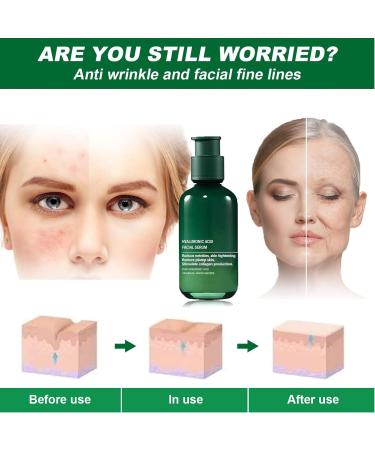 Skin Firming Rejuvenating Serum for Face & Neck - For All Skin Types (2PCS) | Best Anti-Aging Solution - Buy Online on GoSupps.com