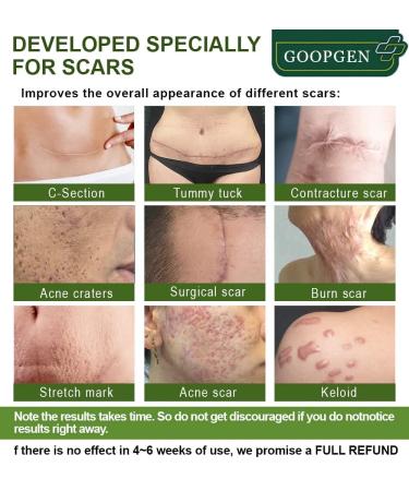 Goopgen Advanced Scar Repair Serum - Medical Grade Treatment for Acne, Surgical Scars, and Stretch Marks (2pcs) - Buy Online on GoSupps.com