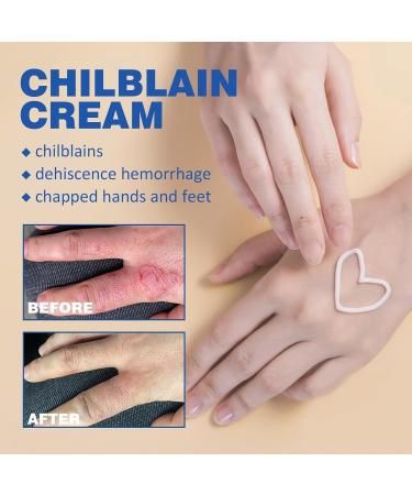 Deep-nourishing crack frostbite and cracking moisturizer cracking and frostbite repair cream for cracked skin for dry and cracked heels Removes calluses - Buy Online on GoSupps.com