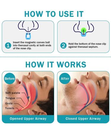 MS Esther Snore Stopper 6Pcs - Silicone Magnetic Anti Snoring Nose Clip for Quieter, Restful Sleep - Buy Online on GoSupps.com