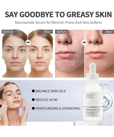 Hyaluronic Acid 2% + B5 Hyalu B5 Serum Dark Spot Remover for Face Hyaluronic Acid Serum for Hydrated Anti Aging Serum Instant Face Tightening &Brightening Serum Bo-Tox Face Serum Plump & Smooth Skin - Buy Online on GoSupps.com