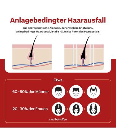 Minoxidil Double Heart 20 mg/ml Solution for Women's Hair Loss - 3x60 ml | Effective Treatment for Thinning Hair | International Shipping - Buy Online on GoSupps.com