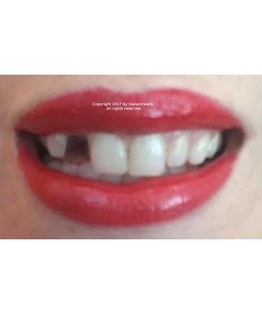 Temporary tooth repair kit temp dental fix missing for 10 teeth! Now with DVD!