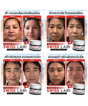Swiss Lab Nature 3 Cream + 2 Serum Big Set | Ultimate 5 Pcs Skincare by Beautygoodshop | Free Beauty Gifts Included - Buy Online on GoSupps.com