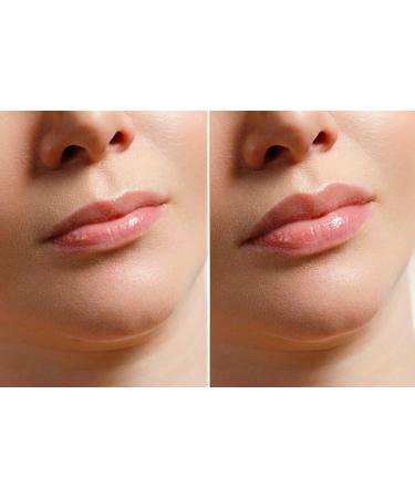  BullTek Lip Plumper Lip Gloss - Clear Lip Gloss with Plumping Treatment - Natural Volumising Effect - Increases Volume Plump Your Lips - Emollient Nutritive Antioxidant - Buy Online on GoSupps.com