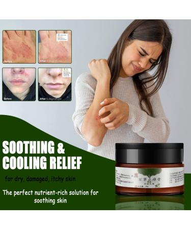 All-Natural Eczema & Psoriasis Cream for Sensitive Skin | Herbal Anti-Itch Lotion for Dermatitis, Shingles, Acne & Rosacea | Soothing Moisturizer for Dry, Itchy Skin (1.06oz & 5.50oz Options) - Buy Online on GoSupps.com