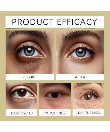  Generisch Retinol Anti-Wrinkle Oil Roll-On Eye Contour Cream Reduces Puffiness Intense Reactivating Eye Balm Moisturizing Nourishes the Face Pampering Care (2) - Buy Online on GoSupps.com