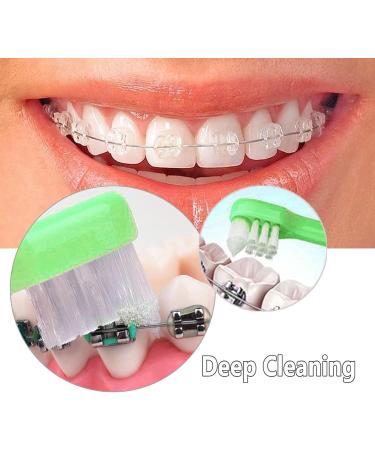 Buy Tepe Toothbrush Set - 4 Interdental Brushes for Braces & Gaps | International Shipping Available - Buy Online on GoSupps.com