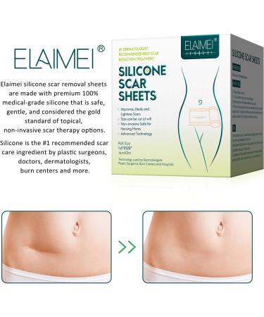 Silicone Scar Removal Foils - Effective Flattening for Surgery Burns Acne & More | 4cm x 300cm - Buy Online on GoSupps.com