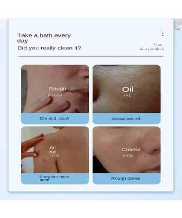 Skin Rubbing Mud Mud Rubbing Artifact Mud Rubbing Gel Mud Rubbing Cream Rubbing Mud Bath Exfoliating Body Scrub Gently Cleanses Skin - Buy Online on GoSupps.com