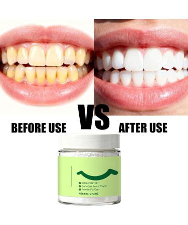 Poudre Dentaire Au Collag ne Poudre Blanchissante Dents Blanchiment Des Dents De Longue Dur e Pour Les Dents Sensibles Nettoyage Cosm tique Des Dents limination Profonde Des Taches Haleine Fra che - Buy Online on GoSupps.com