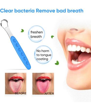 WILsem Tongue Cleaner - Reusable Stainless Steel Tongue Scraper with Non-Slip Handle - Travel-Friendly Blue Mouth Brush - Buy Online on GoSupps.com