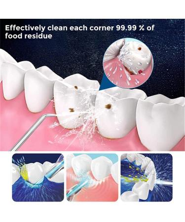 Portable Oral Irrigator Water Flosser with 4 Nozzles - Dental Water Jet for Home and Travel - Buy Online on GoSupps.com
