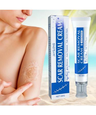  smashing Stretch Mark Cream | 30g Soothing Scar Cream for Hyperplasia | Effective Scar Smoothing for Old and New Scars | Stretch Mark Removal Cream for Men | Smashing - Buy Online on GoSupps.com