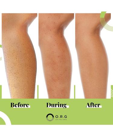 ORG Korean Deep Gel Exfoliating Body Scrub - Natural Cruelty Free Formula for Smooth & Glowing Skin - 6oz - Buy Online on GoSupps.com