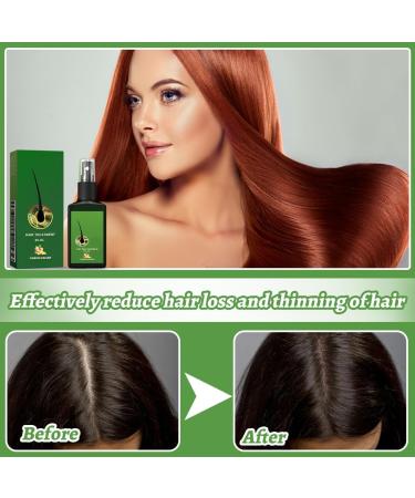 Teegxddy 2 pieces hair growth for men and women accelerates care solution prevents hair loss stimulates beard growth soft universal skin structure 30 ml - Buy Online on GoSupps.com