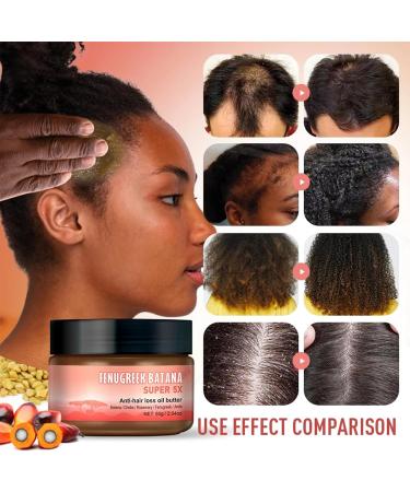Batana Oil Pure Batana Oil for Hair Growth Super 5X Veganic Natural Hair Growth Oil Repair Damaged Hair & Skin Effective Against Regional Alopecia Promote Hair Regrowth - 60ml - Buy Online on GoSupps.com