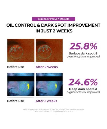 JUMISO Niacinamide 2+ Oil Control Cream - Korean Face Moisturizer for Oily Acne Prone Skin - Pore Minimizing Sebum Balancing with Hyaluronic Acid Tranexamic Acid Galactomyces 2.7 fl.oz - Buy Online on GoSupps.com