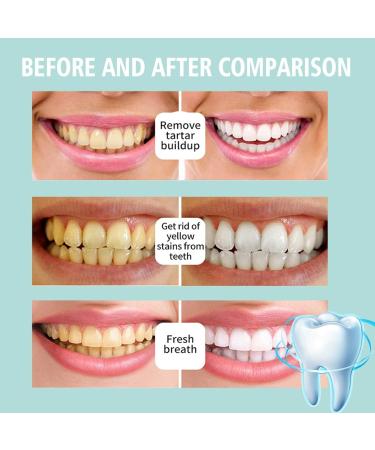 Awzlove Teeth Care Bundle - 2024 Best Mouthwash & Toothpaste for Total Oral Health Lighten Teeth & Combat Oral Issues (3PC) - Buy Online on GoSupps.com