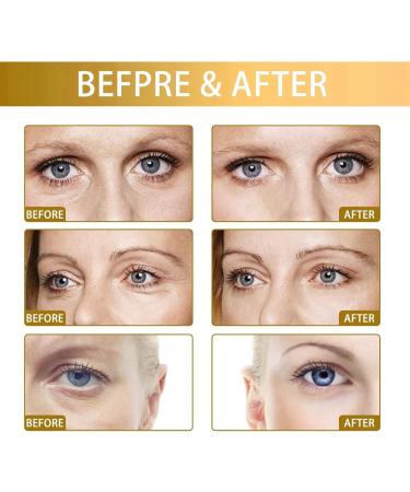 Snail Peptide Energetic Eye Roll-On Firming Eye Cream Eye Cream for Dark Circles and Puffy Eyes Instant-Eye Bag Removal Anti-Wrinkle Eye Cream Under Eye Cream Dark Circles Hydrating &Firming Eye Serum - Buy Online on GoSupps.com