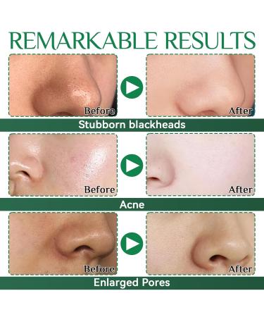 Natural Bamboo Coal Blackhead Remover - 80 Strips for Clogged Pores & Blackhead Removal | Unisex Pore Cleaner - Buy Online on GoSupps.com