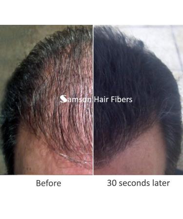 Samson Hair Building Fibers Refill - Compatible with Toppik 100% Undetectable Hair Loss Concealer for Thinning Hair - Black 25g Made in USA - Buy Online on GoSupps.com