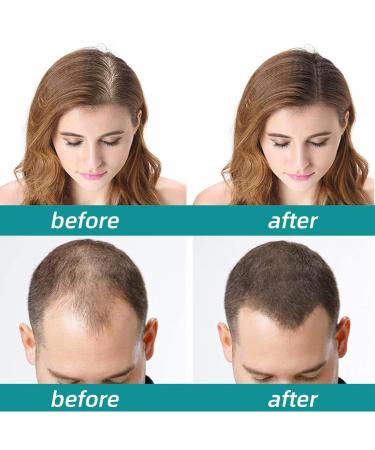 Original Ordinary Hair Growth Serum - Vegan Formula for Thinner Hair & Hair Loss | 60ml - For Men & Women - International Shipping - Buy Online on GoSupps.com