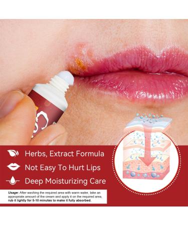 RedOceansM Labial repair gel for the lips helps soothe stinging and burning sensations on the lips immediate fresh effect optimal skin tolerability 20 g - Buy Online on GoSupps.com