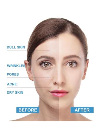 Blueberry Facial Scrub - Brightening Exfoliator & Cleanser for Dull Skin - Ideal for Blackheads & Acne - Vitamin C Scrub for Men & Women - International Shipping Available - Buy Online on GoSupps.com