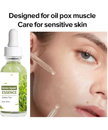 Acne Repair Face Serum Firming Serum For Face Green Tea Hyaluronic Acid Serum Relieve Redness & Acne Natural Face Serum For Acne Day & Night Serum For Face Hydrating Face Oils And Serums-Repair - Buy Online on GoSupps.com