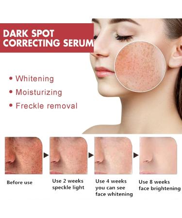 2Pc Niacinamide For Post-Acne Marks Dark Spot Correcting Serum Dark Spot Correcting Glow Serum 10% Niacinamide Niacinamide Serum Facial Care Against Pigmentation Spots And Age Spots - Buy Online on GoSupps.com