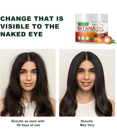Raw Batana Oil for Hair Growth 100% Natural Organic Batana Oil Prevent Hair Loss Nourishes Scalp Reduce Dry Damanged Hair Unrefined Promotes Hair thickness for Men & Women Hair Care (120 Grams) 120 Grams - Buy Online on GoSupps.com
