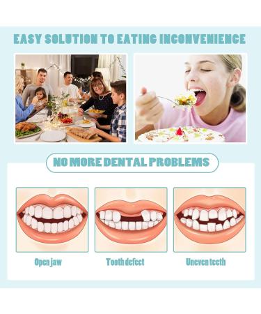 Euppsiiu 2-Piece Acrylic Resin False Teeth Veneers - Cosmetic Tooth Covers & Temporary Dental Prosthesis - Buy Online on GoSupps.com