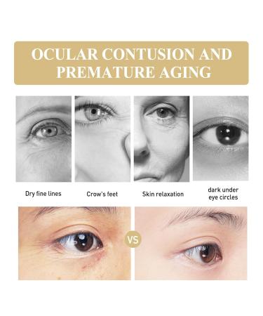 Dryic Anti-Aging Eye Cream - Fade Folds Moisturize & Care for Your Eyes | International Shipping Available - Buy Online on GoSupps.com