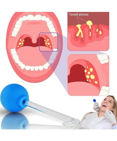 Tonsillenstein Remover | Effective Almond Stone Cupping Glass for Tonsil Stone Removal & Fresh Breath Oral Care - Buy Online on GoSupps.com