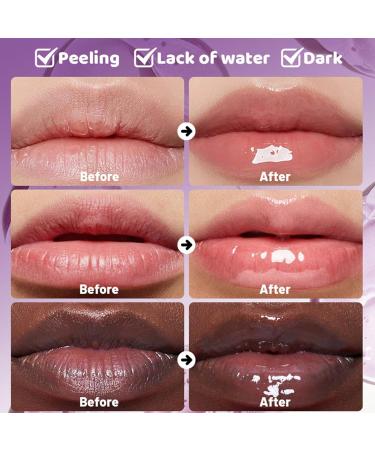  Ziennhu Skin Food Lip Balm - Intensely Repairs and Nourishes Dry and Chapped Lips - Protects Against Dryness Milano Lip Balm | Intensive Nourishing Lip Balm Cica Serum Stick - Buy Online on GoSupps.com