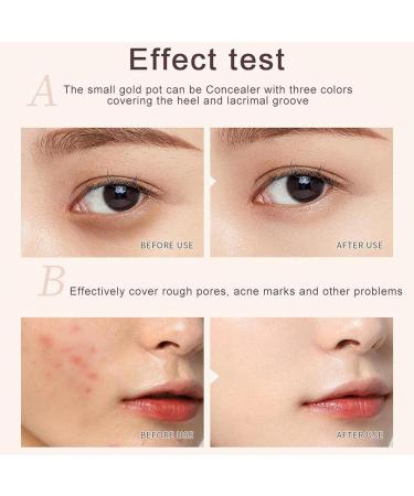 Tri-color Cream Concealer Palette for Dark Skin | Full Coverage Concealer for Acne Marks and Spots - Buy Online on GoSupps.com