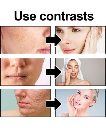 Face Scrub Exfoliating Face Scrub Instantly Reveals Skin Natural Glow Face Exfoliating Gel for Women and Men Removes Blackheads Improves Dark Spots and Acne Smoothes The Skin Natural Formulation - Buy Online on GoSupps.com