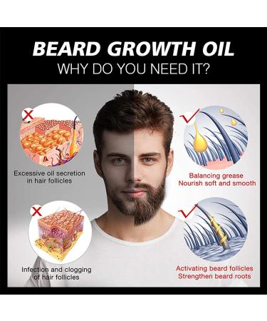 Buy Beard Growth Oil - Daily Support Formula for Moisturizing & Repairing Damaged Hair - 30ml - Buy Online on GoSupps.com