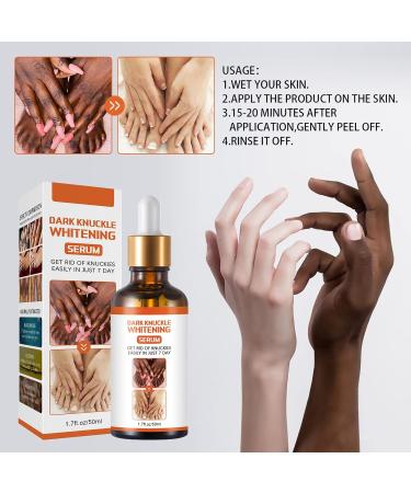 50g Dark Knees and Elbows Lightening Serum Dark Spots Cream Body Whitening Serum Dark Knuckles Whitening Serum Strong Whitening Serum Removing Dark Knuckle Finger Elbow and Knee - Buy Online on GoSupps.com