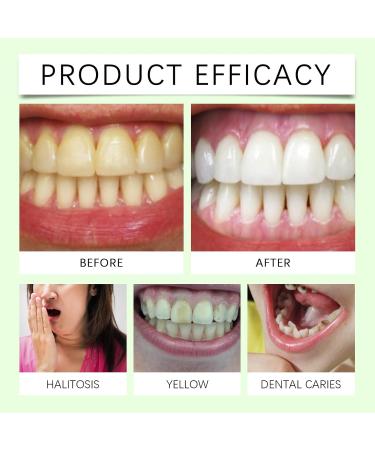Aloe Vera & Mint Toothpaste - Gentle Care Removes Stains/Yellowing/Odor Fights Plaque Fresh Breath(3PCS) - Buy Online on GoSupps.com